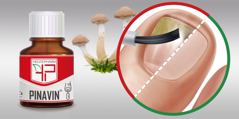 PINAVIN®. Предназначен для полного избавления от ногтевого грибка
