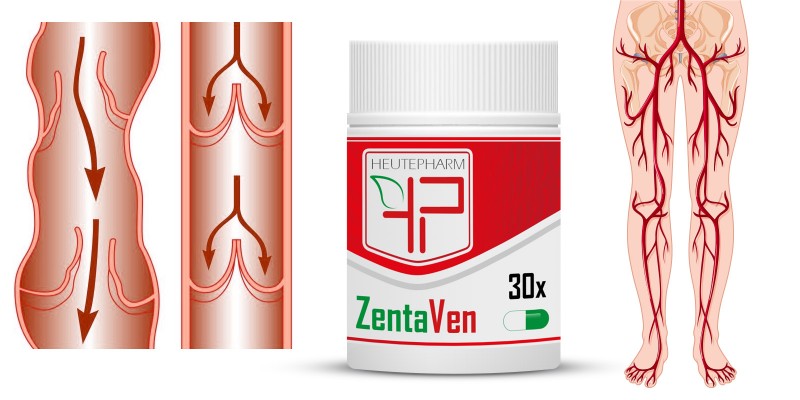 ZentaVen® (ЦентаВен) Диетическая добавка для вен, 30 капс